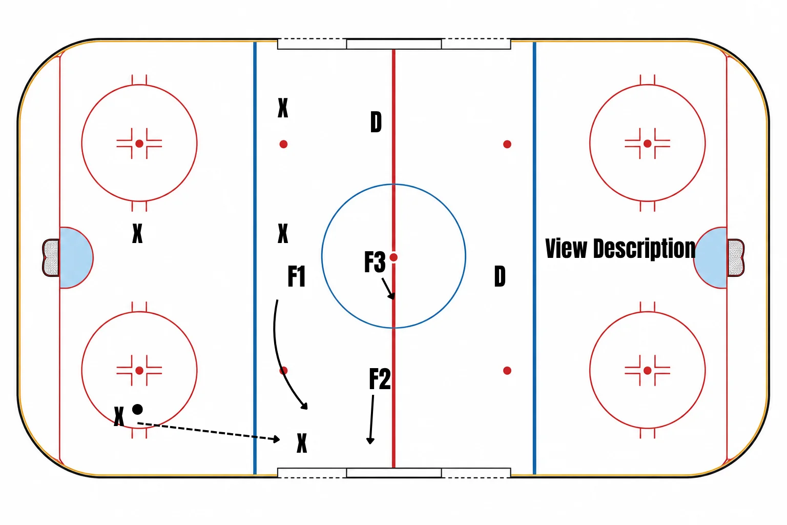 1-3-1 Neutral Zone Trap